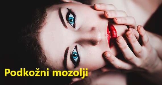 podkožni mozolj