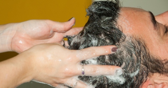 Prhljaj: Kako se znebiti prhljaja s šamponi proti prhljaju?