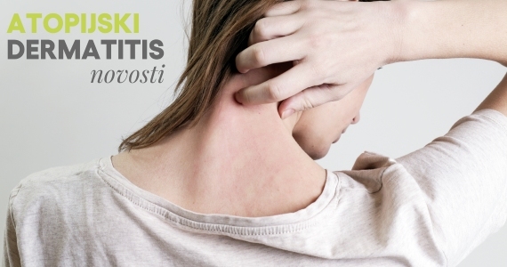 Atopijski dermatitis - novosti