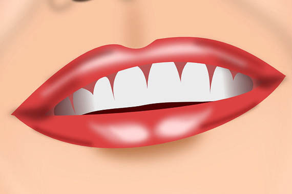 Zdrava ustna votlina za prepričljiv nasmeh - Slika 1