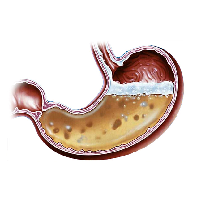 Slika želodca