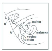 canesten3 krema